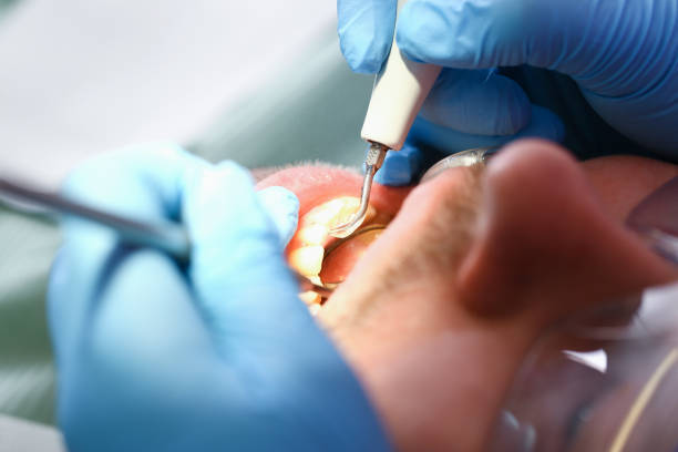 Best Emergency Denture Repair in Sherwood, WI