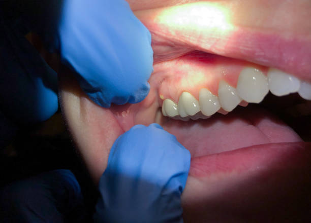 Best After-Hours Dental Trauma Care in Sherwood, WI