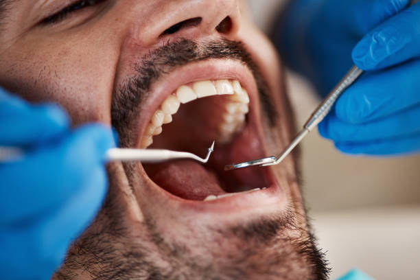 Best Emergency Dental Care for Broken or Chipped Teeth in Sherwood, WI