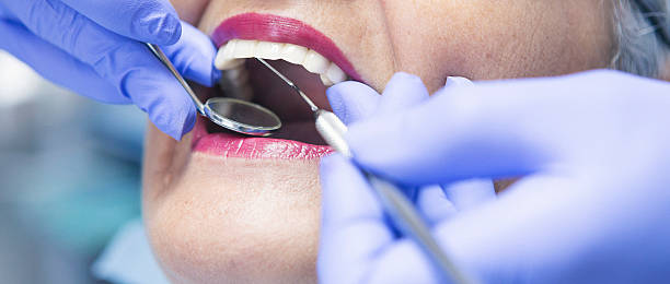 Best Emergency Dental Care for Broken or Chipped Teeth in Sherwood, WI